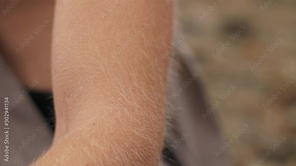 Hair stood on end and goosebumps Hair stood on end and goosebumps
