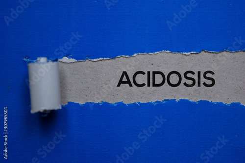 Acidosis Text written in torn paper. Medical concept photo