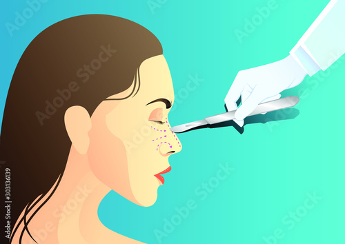 stock vector of hand holding scalpel on woman nose. side view women face. describe of plastic surgery, surgical cosmetic procedure. for advertising and medical publications.