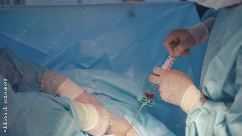 Bone marrow transplant operation. Team surgeons operation bone marrow transplant Bone marrow transplant operation. Team surgeons operation bone marrow transplant