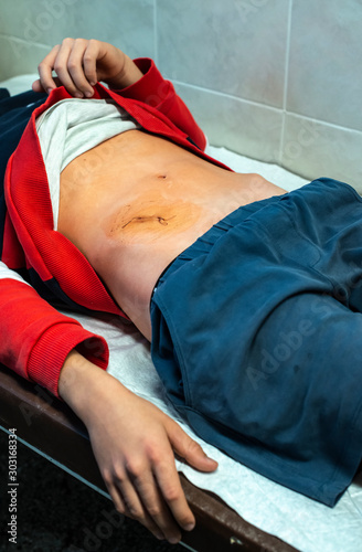 Young teenage boy in hospital. Concept for wound from surgery.