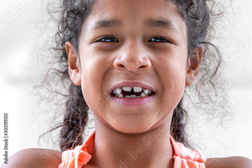 фотографія close up girl mouth with crooked broken teeth and odontolith, will need a dental
