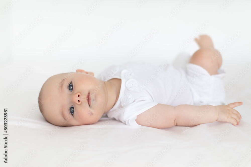 Cute little baby girl with hemangioma on her face Cute little baby girl with hemangioma on her face