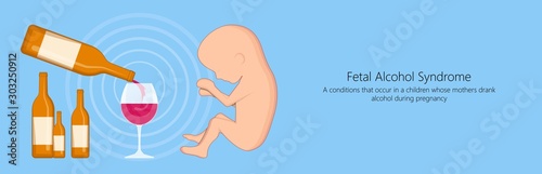 Fetal alcohol spectrum syndrome disorders conditions mother drank during pregnancy cause brain damage and birth defect in children