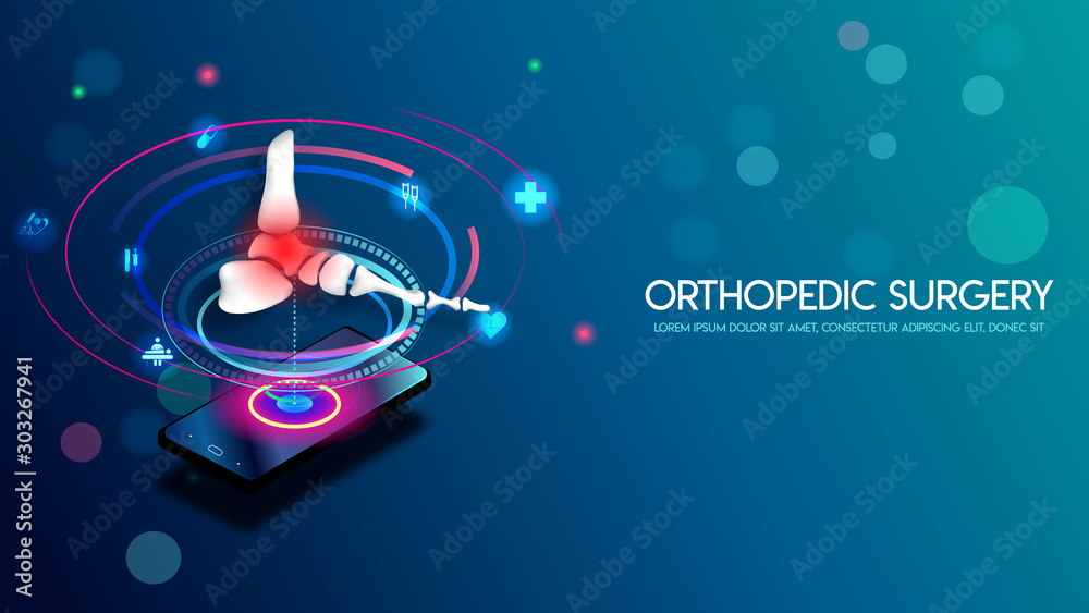 Obraz premium Medical orthopedic and the future of the smart hospital. Treatment for orthopedics traumatology of foot bones and ankle joints injury. Medical presentation, hospital. Vector illustration