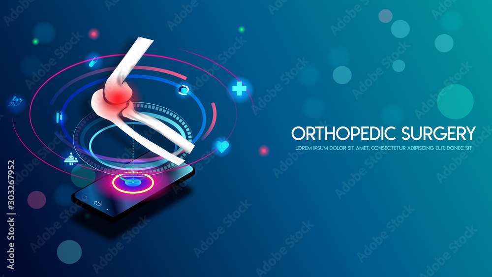 Medical orthopedic and the future of the smart hospital. Treatment for orthopedics traumatology of elbow bones and joints injury. Medical presentation, hospital. Vector illustration