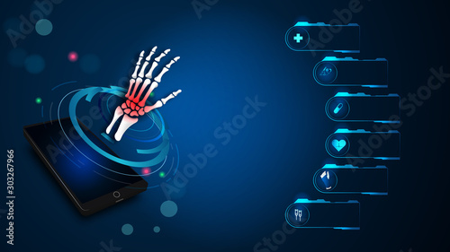 Medical orthopedic and the future of the smart hospital. Treatment for orthopedics traumatology of hand bone and joints injury. Medical presentation, hospital. Vector illustration