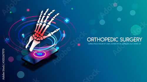 Medical orthopedic and the future of the smart hospital. Treatment for orthopedics traumatology of hand bone and joints injury. Medical presentation, hospital. Vector illustration