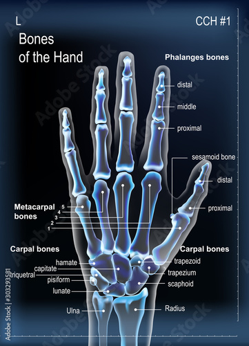Frontal view x ray of bones the of hand with anotations.