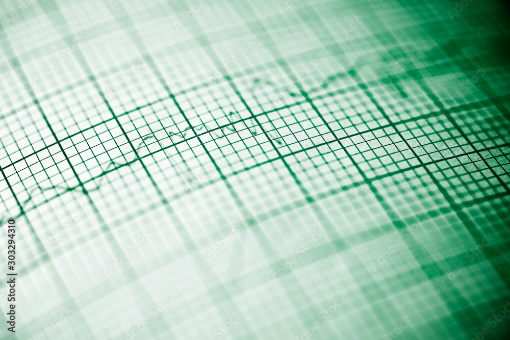 Electrocardiogram close up Electrocardiogram close up