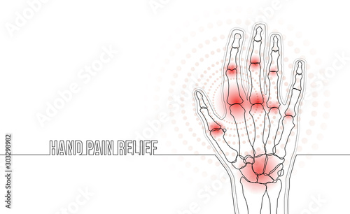 Rheumatoid arthritis continuous line hand bones drawing concept banner
