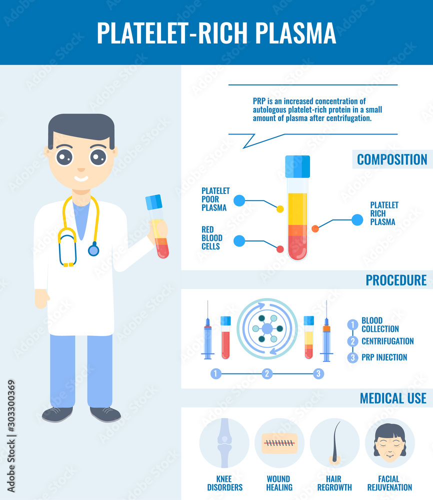 PRP big infographic vector set of platelet-rich plasma procedure, blood composition and medical use. Doctor holding a test tube for injection. Stem cell regeneration for beauty and medical treatment.