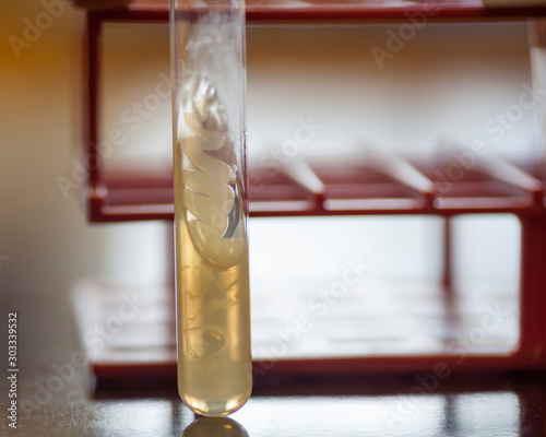 Bacteria growing on an agar slant. photo