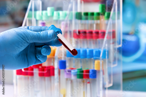 technician holding a blood sample tube for analysis in the lab / doctor with blood sample to analyze in the preanalytical laboratory