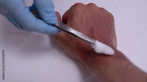 A doctor or nurse wearing gloves removes dead skin from the patients hands from burns with medical instruments. 4k footage.