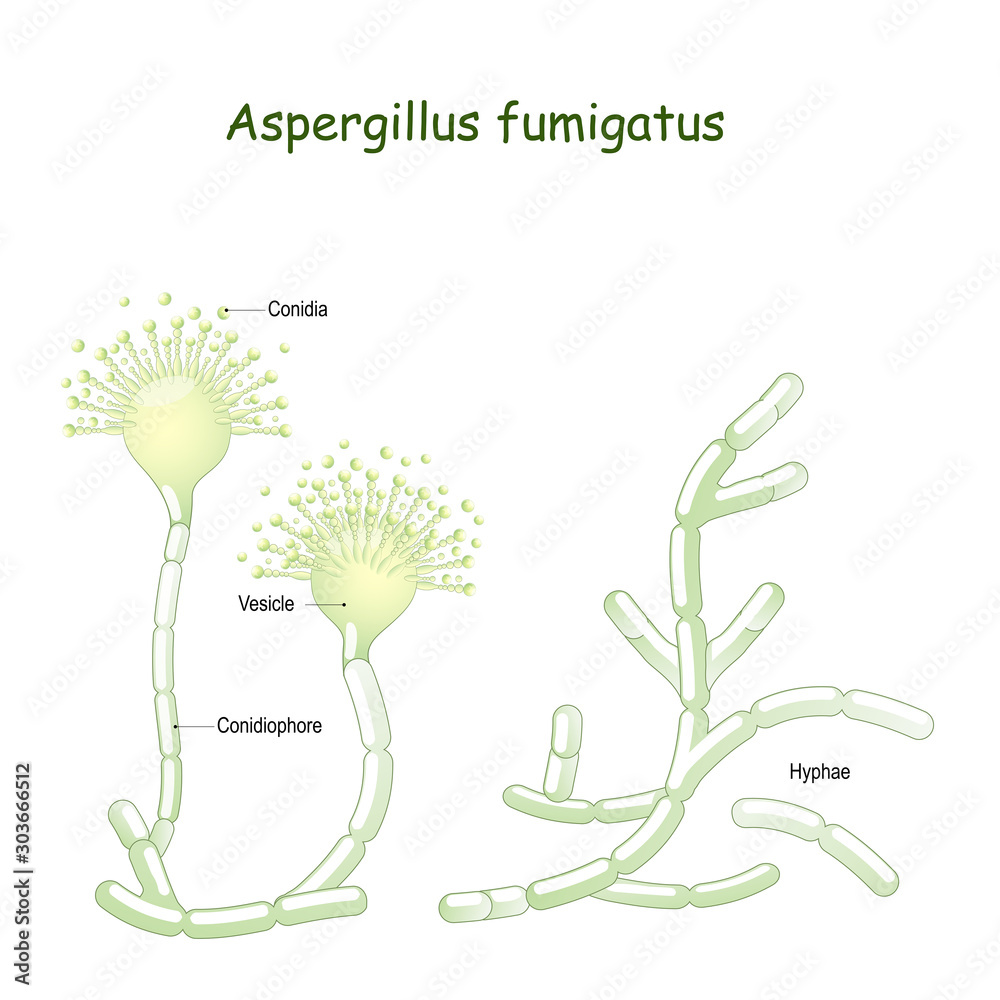 Aspergillus fumigatus is  a type of fungus causes aspergillosis - obrazy, fototapety, plakaty 