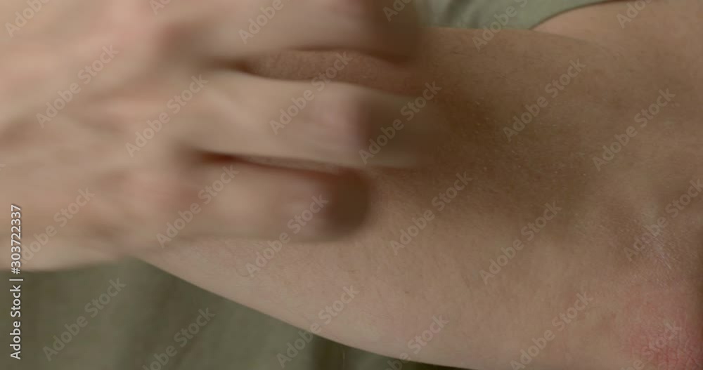 Detail of Caucasian man's hand scratching an itch on the back of his other arm. Close-up with shallow focus, 4K Detail of Caucasian man's hand scratching an itch on the back of his other arm. Close-up with shallow focus, 4K