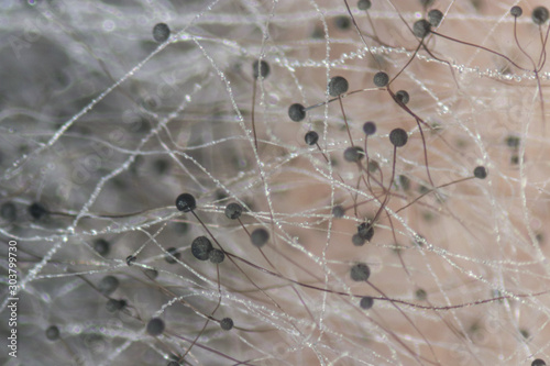 Rhizopus  bread mold  is a genus of common saprophytic fungi Rhizopus  bread mold  under the microscope.