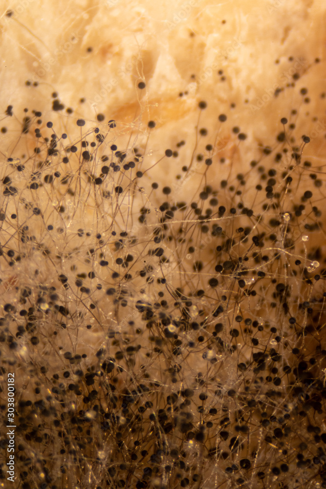 Rhizopus (bread mold) is a genus of common saprophytic fungi,Rhizopus (bread mold) under the microscope. Rhizopus (bread mold) is a genus of common saprophytic fungi,Rhizopus (bread mold) under the microscope.