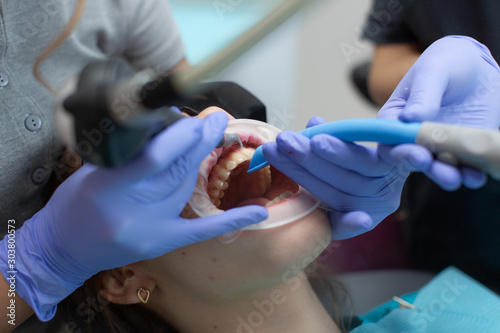 Hygienic cleaning of teeth from plaque close-up.