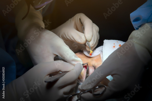 Ophthalmologist currently undergoing eye surgery procedures. photo