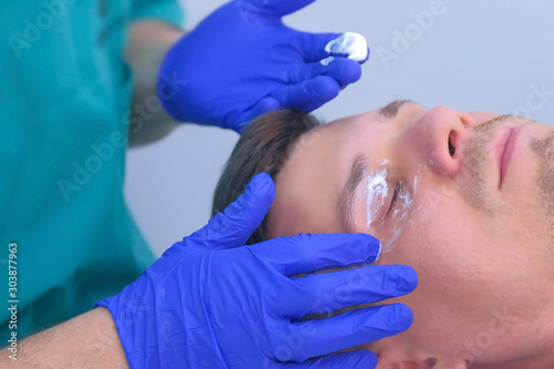 Surgeon in sterile gloves applying cream with anesthetic around eyes before papillomas laser removing in clinic for man patient. Growths on eyelids skin, side view, face closeup. Prepare to cure.