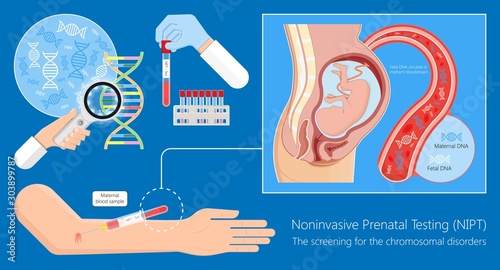 Noninvasive prenatal testing NIPT screening genetic disorders bloodstream cfDNA lab plus diagnostic diagnose 21 18 13 cell free chromosomal abnormalities NIFTY exam simple