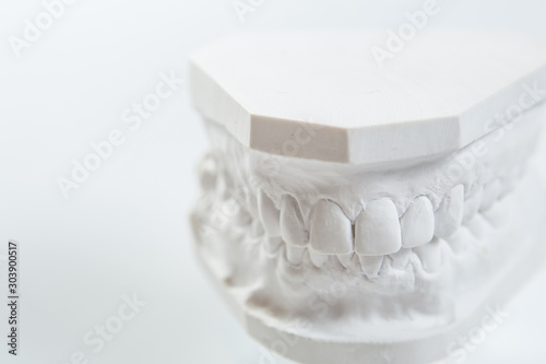 Gypsum model of human jaw on a white background. photo