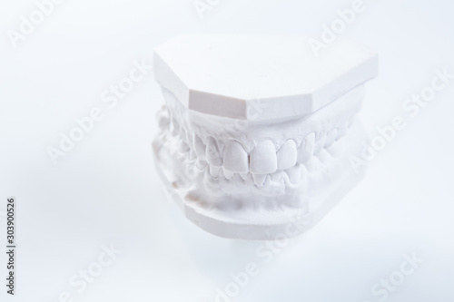 Gypsum model of human jaw on a white background. photo