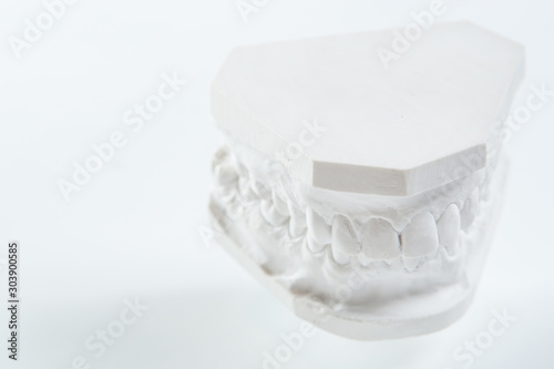 Gypsum model of human jaw on a white background. photo