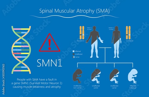 Spinal muscular atrophy SMA genetic disorder