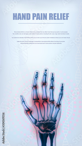 Vertical rheumatoid arthritis hand sore joints concept for social media