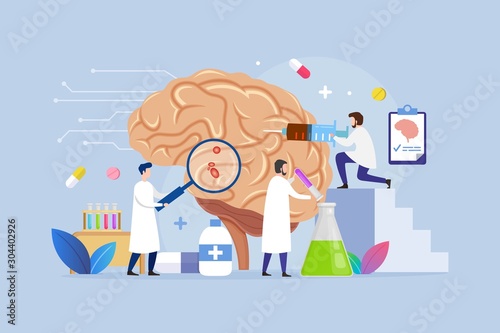 Brain inner organs disease treatment Modern process design concept with Tiny neurologist Character people Vector Illustration