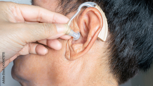 Tableau sur toile Doctor insert digital hearing aid in senior deft patient ear in hospital,high te