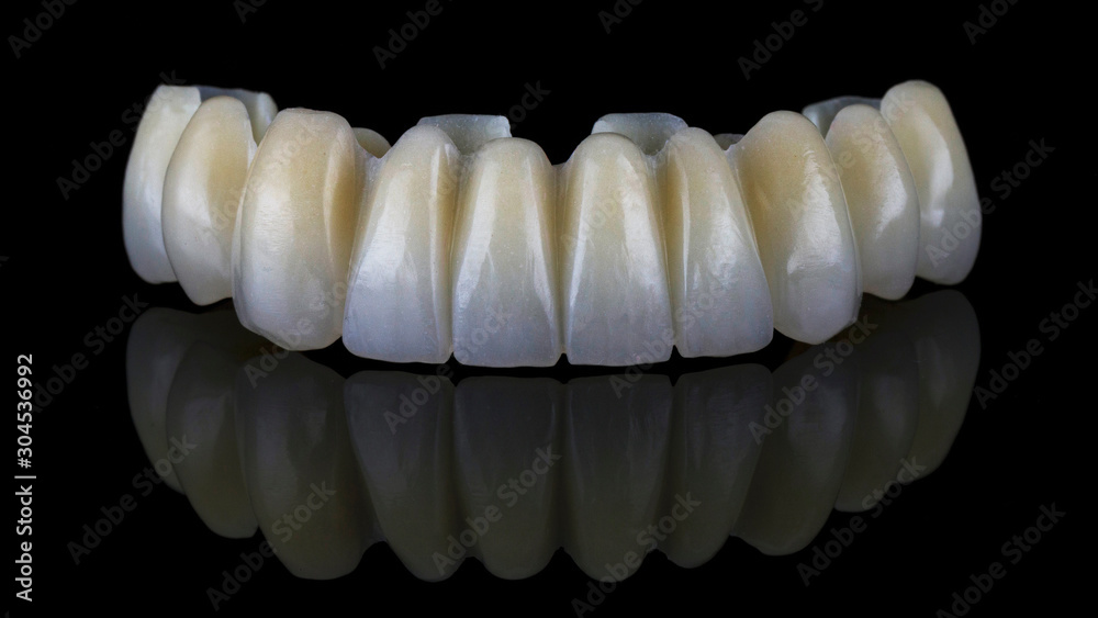 high-quality temporary denture for the upper jaw without a beam on black glass high-quality temporary denture for the upper jaw without a beam on black glass
