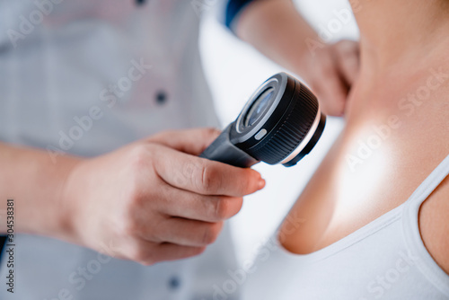 Close up of female doctor checking skin of girl with dermatoscope in clinic photo
