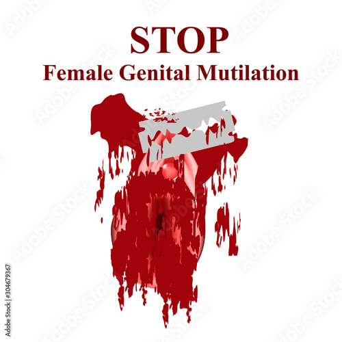 International Day of Zero Tolerance for Female Genital Mutilation. Female external genitalia. The vulva blade cuts. Female circumcision. Circumcision of the vulva and clitoris in Muslims. Vector