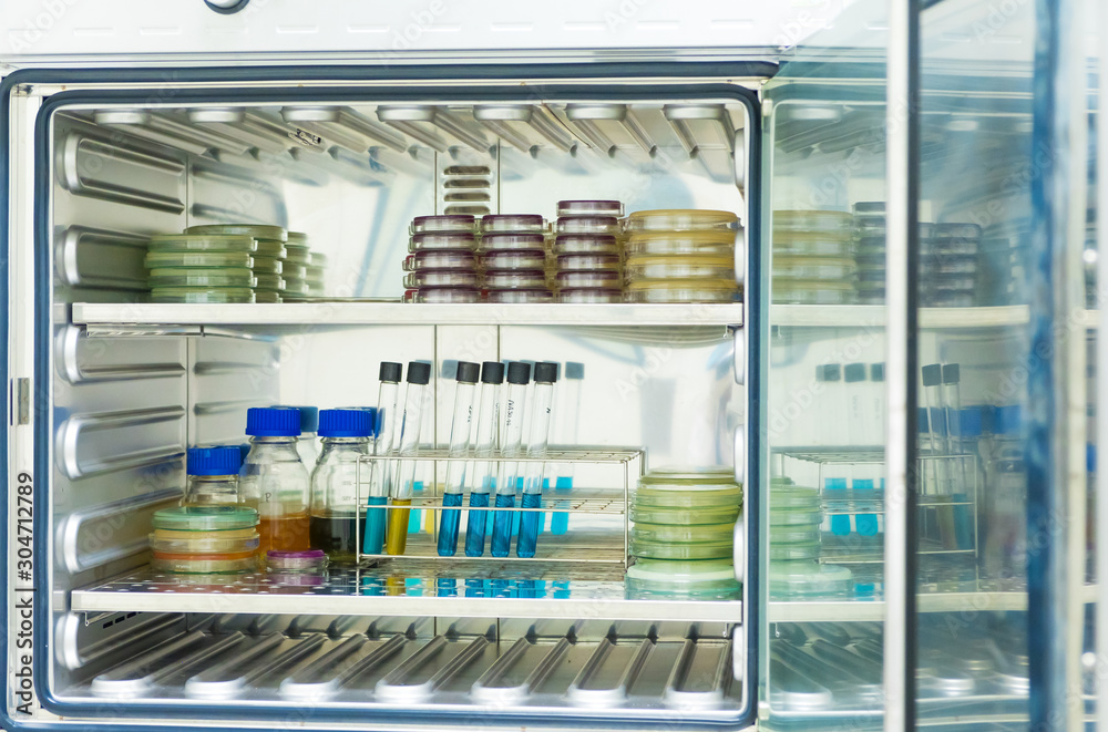 Agar medium and broth from the microbial test incubate in the incubator