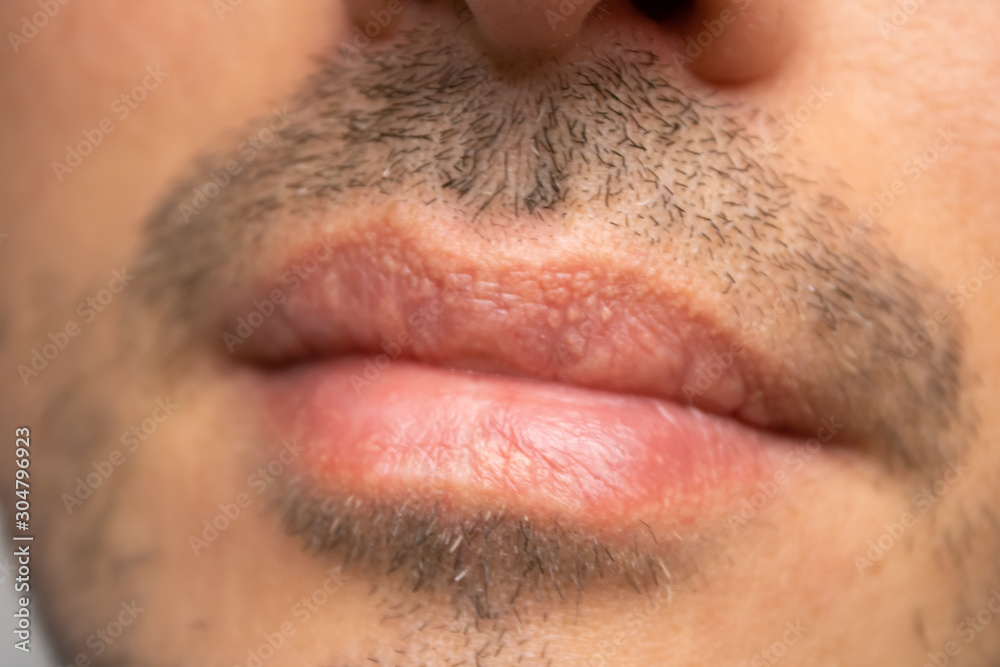 Male NU Lips. Young man closeup lips, male permanent make up, men's bristle. Male NU Lips. Young man closeup lips, male permanent make up, men's bristle.