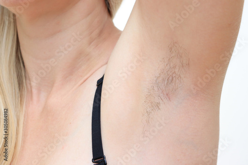 Cuadro en lienzo Hairy unshaved anderarms, armpit of a caucasian woman close up