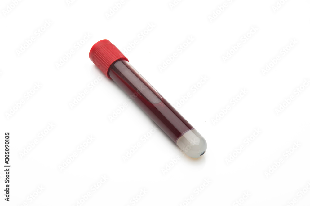 test tube with blood isolated on white background test tube with blood isolated on white background