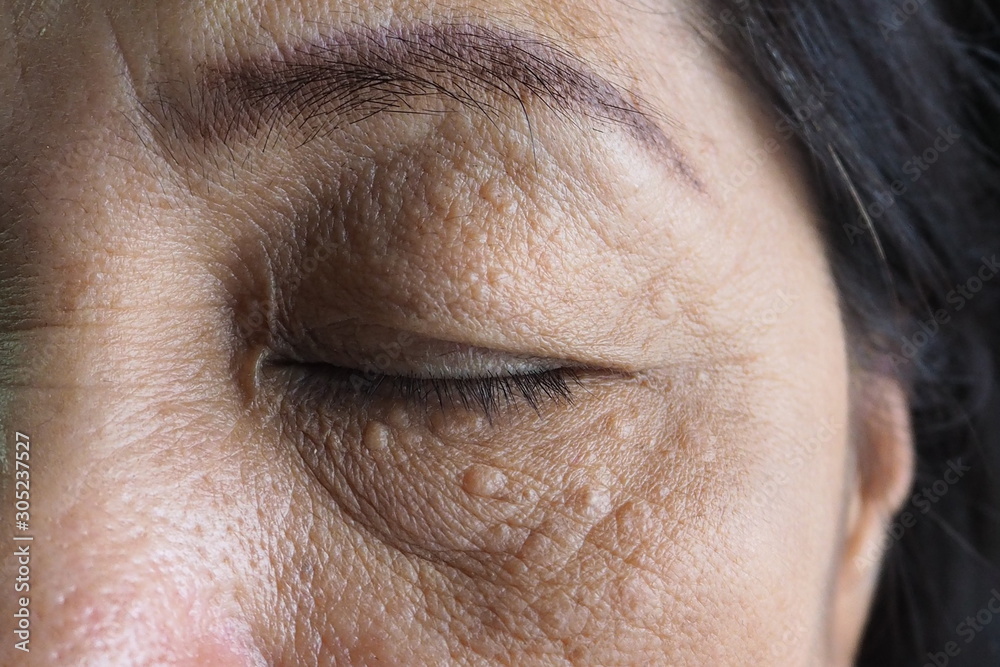 Obraz premium Closeup of wrinkles in Asian woman face skin in deep layers. Skin repair and treatment concept for elderly and aged people. Healthcare, medical, eyes lift, face lifting and aesthetic concept