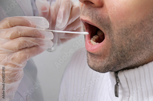 lab assistant in gloves takes a man’s saliva sample from his mouth for DNA analysis, a concept of police investigation and medical examination, close-up