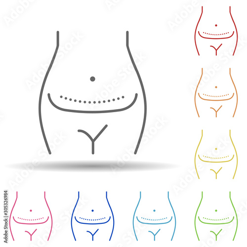 Abdominoplasty, woman in multi color style icon. Simple thin line, outline vector of anti age icons for ui and ux, website or mobile application