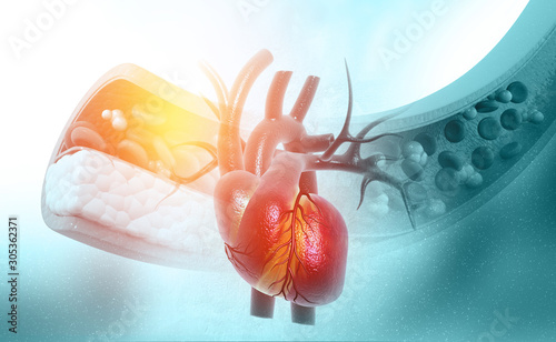 Cholesterol blocked artery with heart.3d illustration photo
