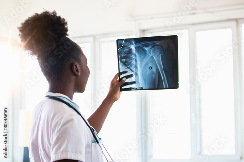 X-ray film image with doctor for medical and radiological diagnosis on female patient’s health on disease and bone cancer illness, healthcare hospital service concept photo