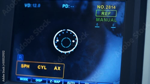 Refractometer machine. Patient testing eyes in clinic. Screen showing progress of eye examination. Close-up.