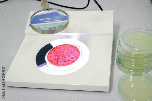 Colony counter and fluid in petri dish glassware with growing cultures of microorganisms, fungi and microbes ware plate tower, microorganism and biotechnology laboratory experiment concept. photo