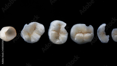 dental photo dental ceramic tabs on black glass, top view