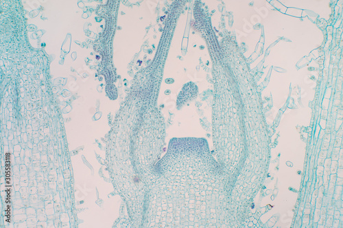 Shoot meristem is the tissue in most plants containing undifferentiated cells. photo